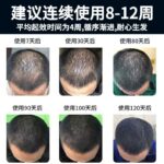 Kirkland 5% Minoxidil For Men's Hair Growth